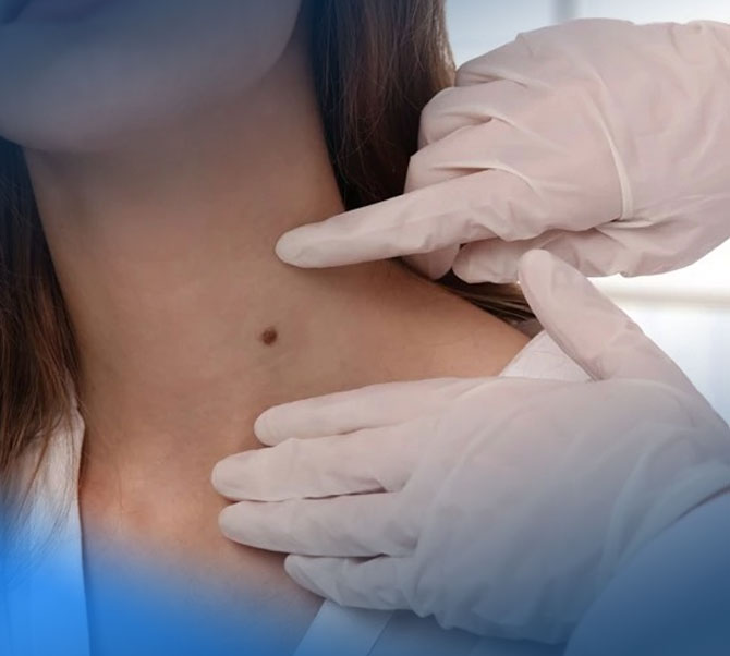 Dermatologia Cirúrgica em Manaus tratamento de cancer e lesoes na pele