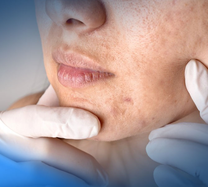 tratamento dermatologico de doenças da pele