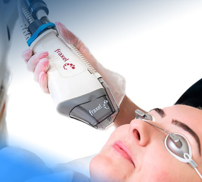 laser fraxel em manaus