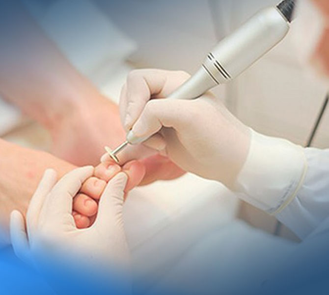 cirurgia dermatologica de de unhas