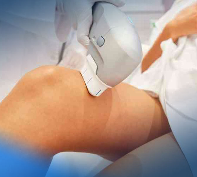 ultraformer-para-o-corpo-Tratamentos-e-estetica-corporal-em-manaus-(clinica-Cavalcante-e-Cirino)