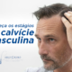 estagios da calvicie masculina