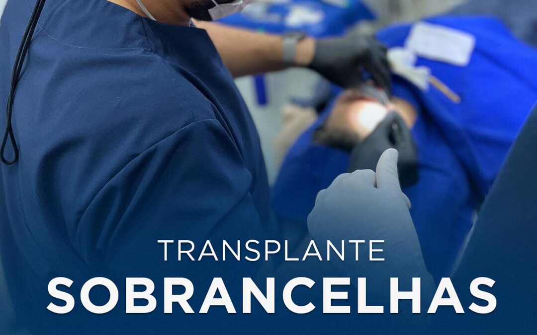 transplante de sobrancelhas em manaus