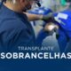 transplante de sobrancelhas em manaus
